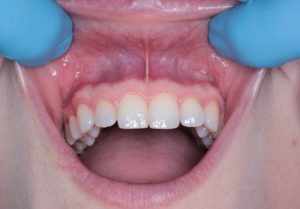 teeth